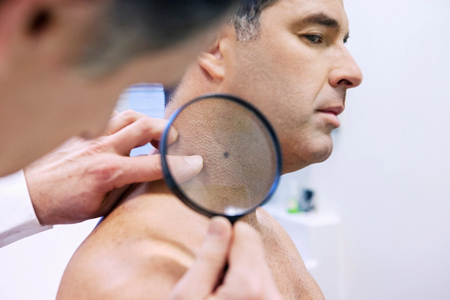 Skin Screening Clinics